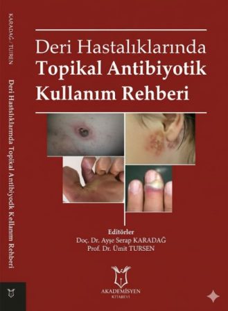 deri-hastaliklarinda-topikal-antibiyotik-kullanim-rehberi-747×1024